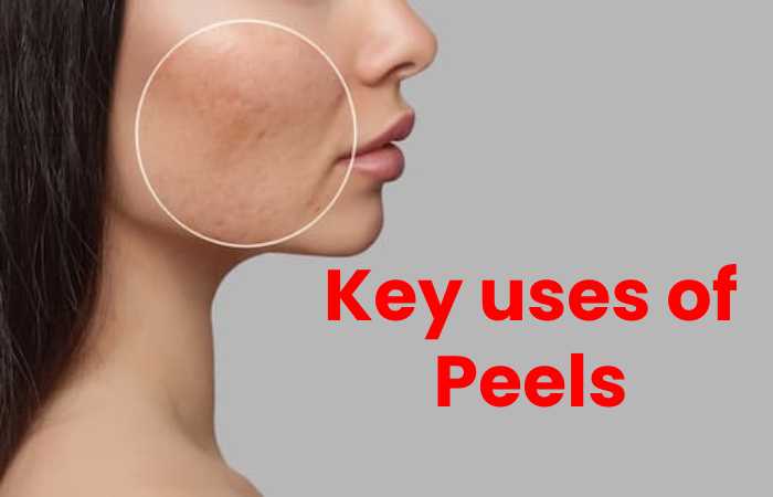Key uses of Peels