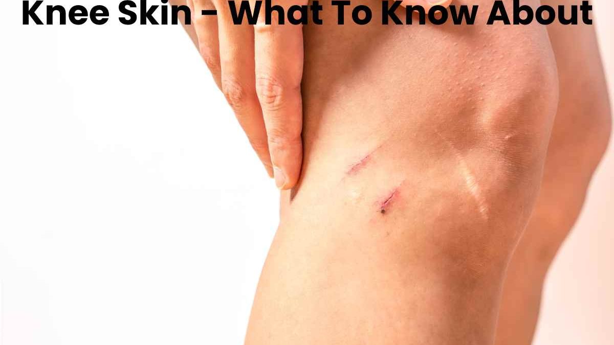 Knee Skin – What To Know About