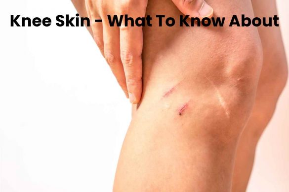 Knee Skin - What To Know About