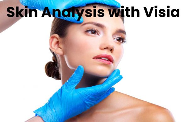 Skin Analysis with Visia