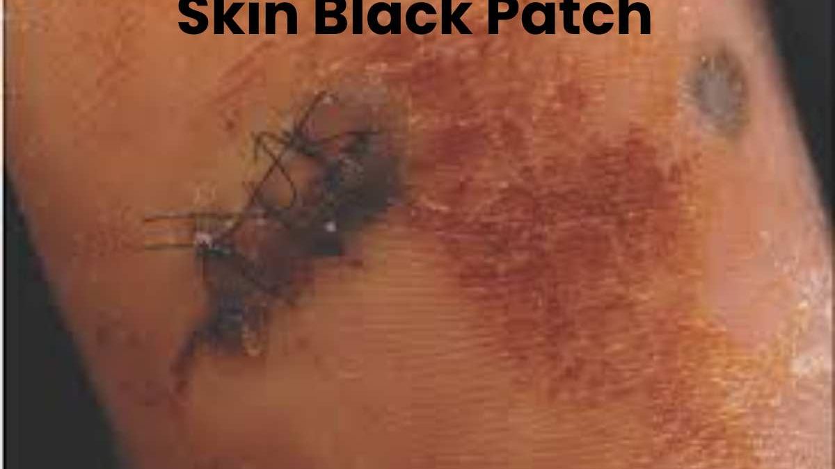 Skin Black Patch