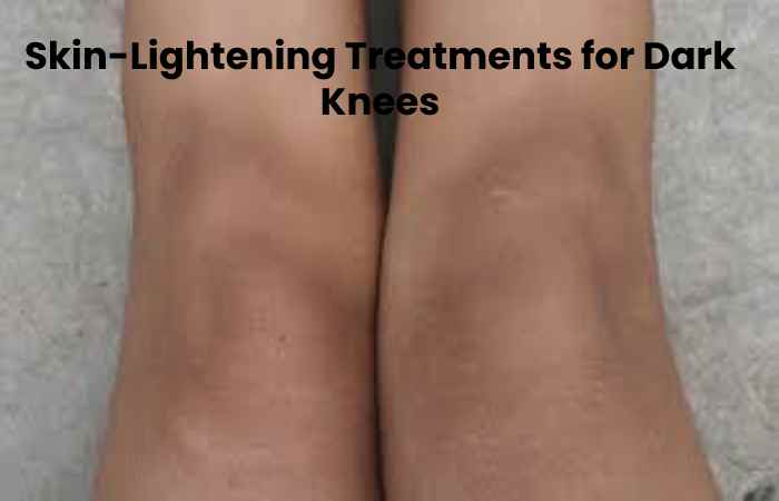 Skin-Lightening Treatments for Dark Knees