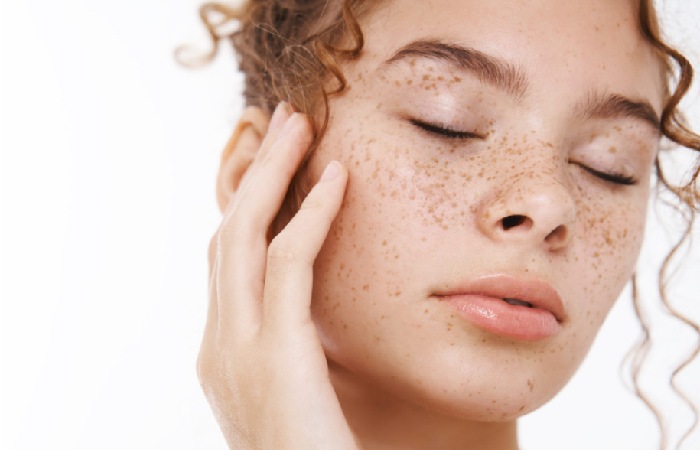 What Causes Skin Discoloration