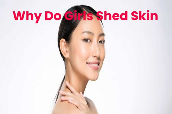 Why Do Girls Shed Skin