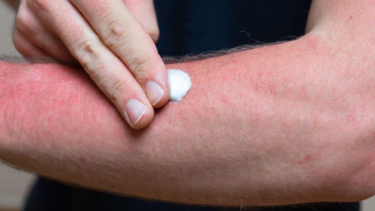 Your Secret Weapon for Chafing and Sweat Rash Relief