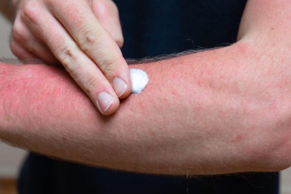 Your Secret Weapon for Chafing and Sweat Rash Relief