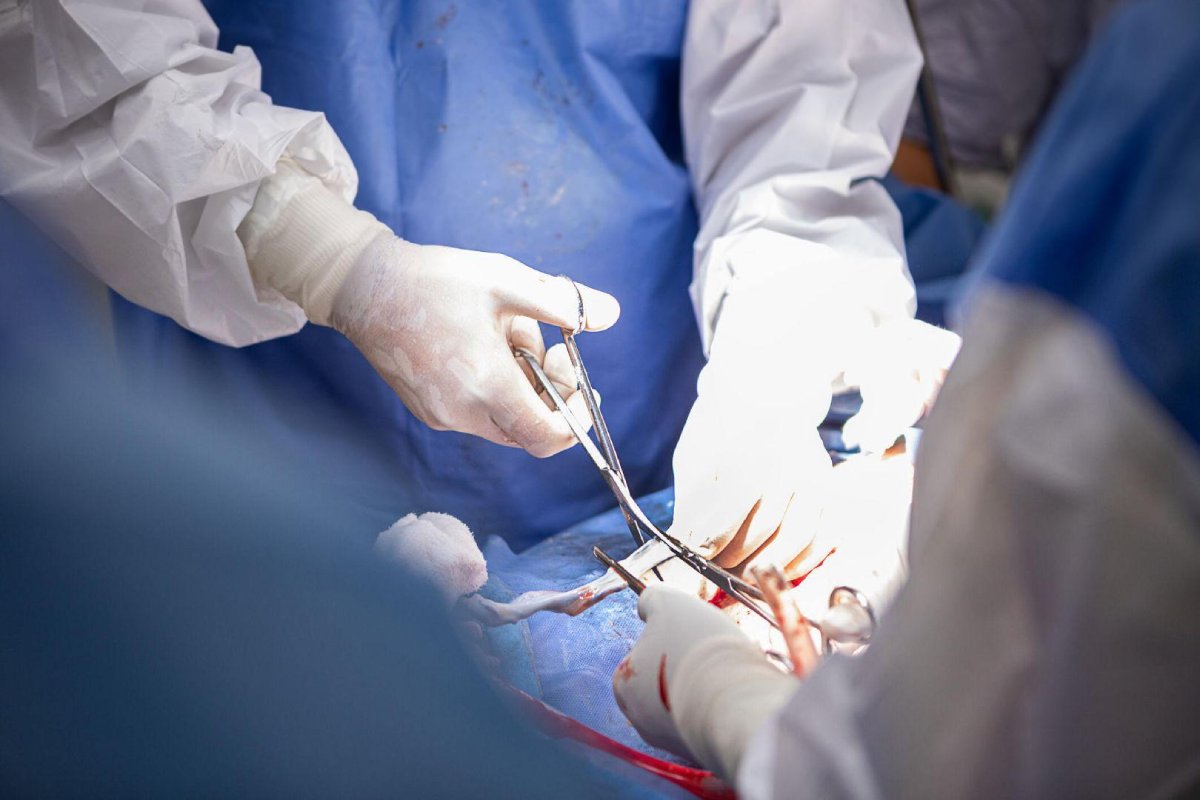 Female Genital Surgery Everything You Need To Know