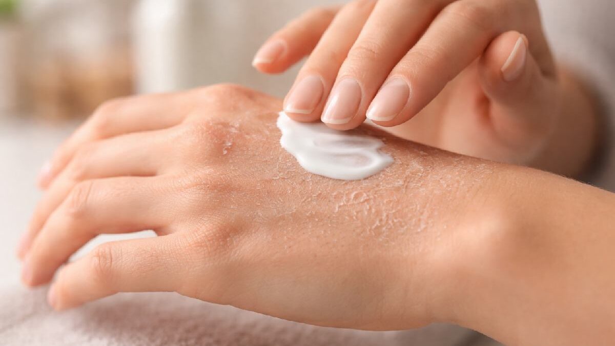 Managing Dry Skin: Dermatologist Solutions That Work (2026)